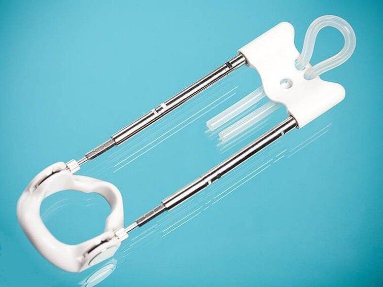 Se recomienda utilizar un extensor de bucle junto con una bomba de vacío.