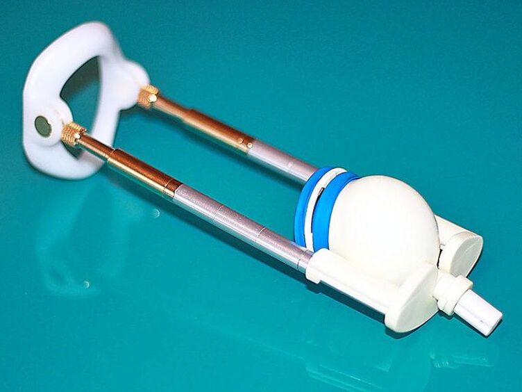 Un extensor de vacío ayudará a mejorar los resultados del bombeo.